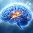 New Advances in Epilepsy Treatment, Epilepsy